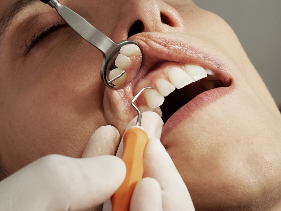 Revisión dental con espejo e instrumental