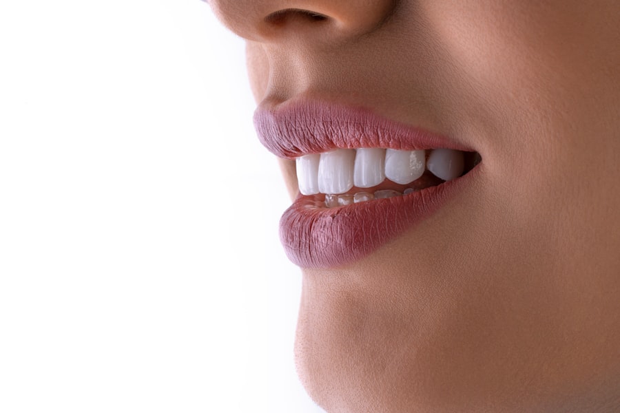 Sonrisa con dientes blancos